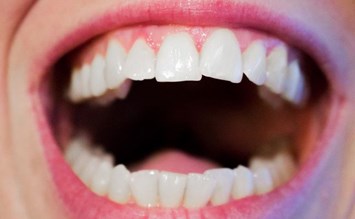 Schöne Zähne und zahnchirurgische Eingriffe - Schoenheitsklinik.info