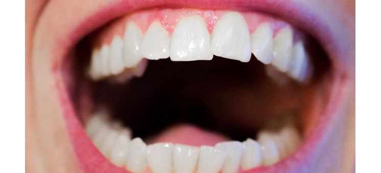 Schöne Zähne und zahnchirurgische Eingriffe - Schoenheitsklinik.info