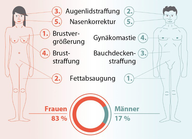 Die beliebtesten Schönheitsoperationen bei Frauen und Männern - Schoenheitsklinik.info