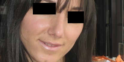 Schönheitskliniken - Augenringe entfernen - Schwarzes Meer - Westtürkei - Nasenkorrektur - Cevre Hospital Istanbul