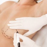 Schoenheitsklinik: Erfahren Sie auf meiner Webseite mehr zum Thema der Bruststraffung:

http://www.drpatrickbauer.de/bruststraffung-muenchen.html - Dr. med. Bauer - Ästhetische Brustchirurgie